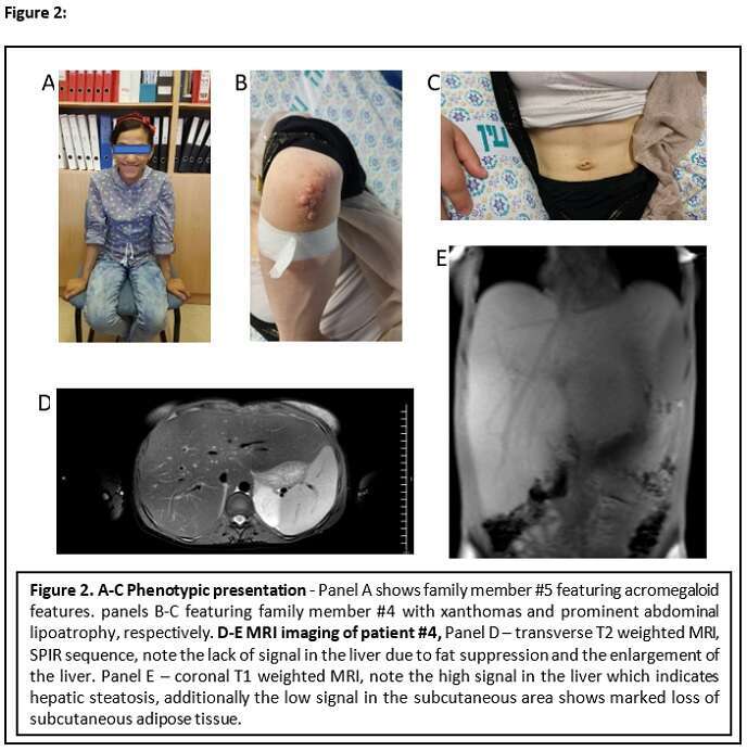 Figure 2. Phenotypic presentation 